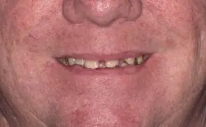 Before - Dr Stavros
